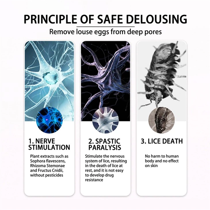 Head Lice Flea Tick Louse Egg Removing Treatment Spray